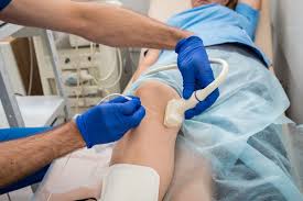 Vascular Imaging