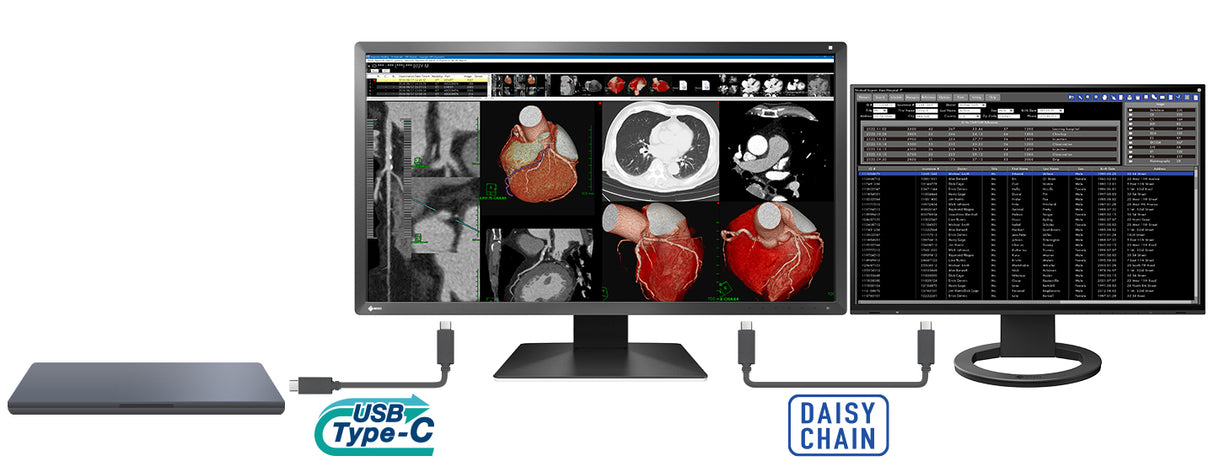Teleradiology Workstation