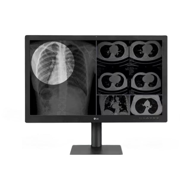 LG 8/6/4 MP Color Diagnostic Monitor
