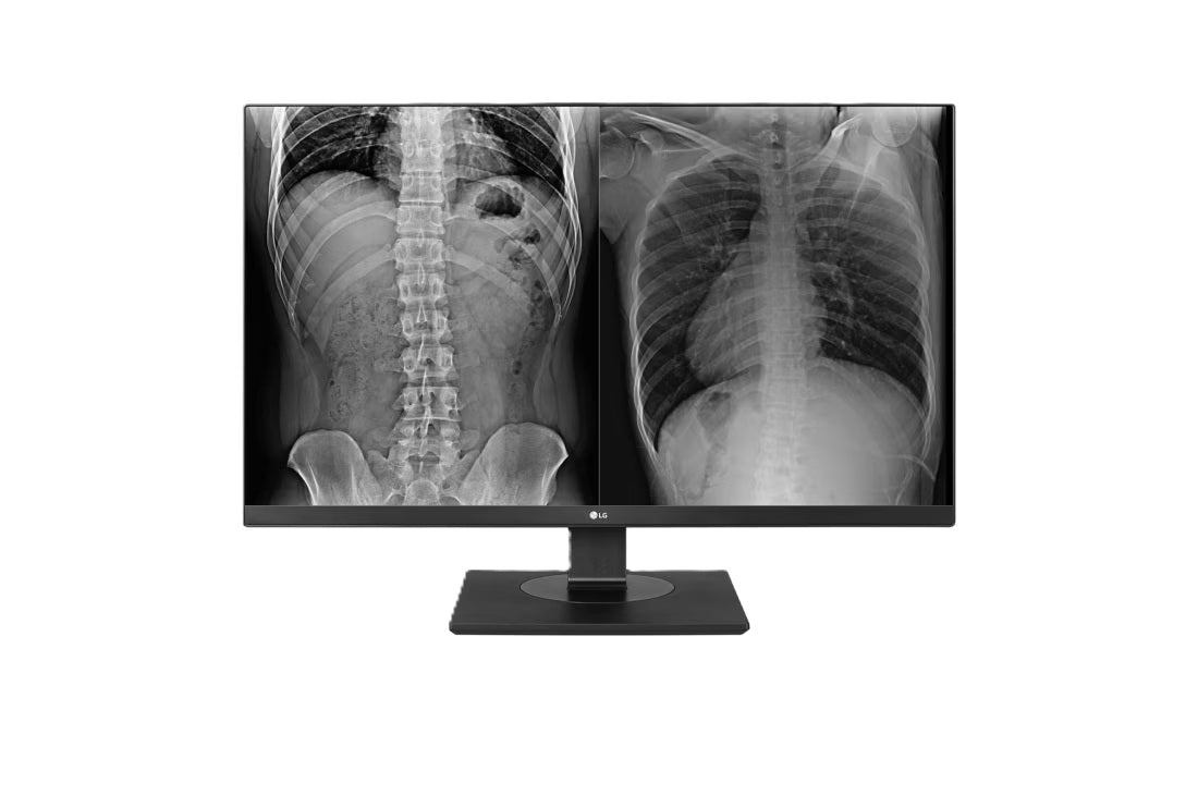 LG 8MP Clinical Monitor