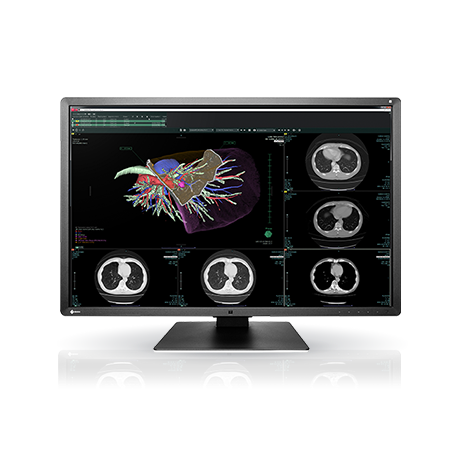 Eizo Radiforce RX660