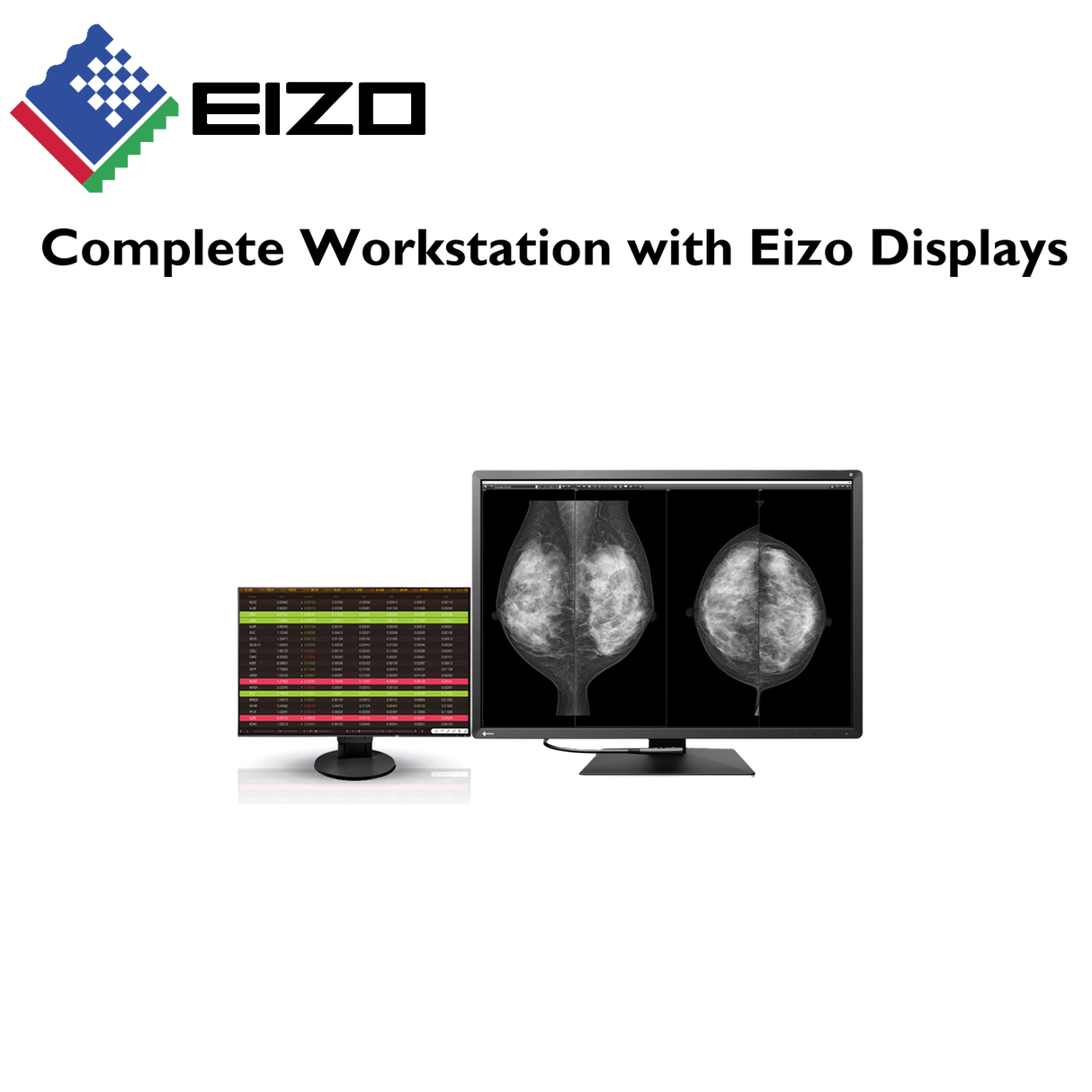 Radiologist Mammography Workstation