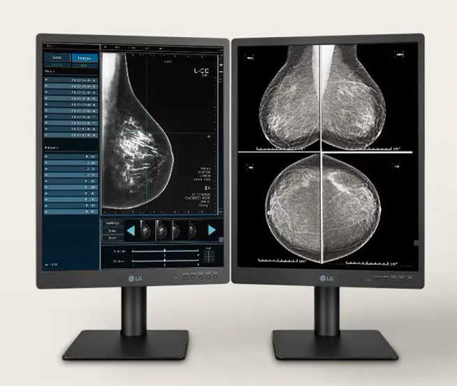 LG 5MP Diagnostic Monitor