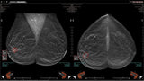 WorkstationOne for Breast Imaging