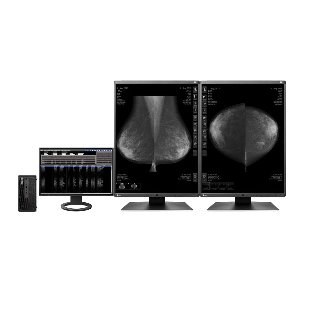 Radiologist Mammography Workstation