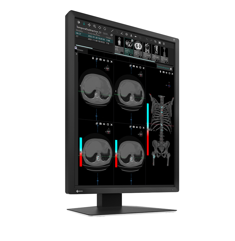 Eizo Radiforce MX217 - Clinical Display