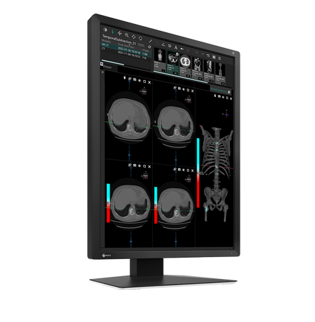 Eizo Radiforce MX217 - Clinical Display