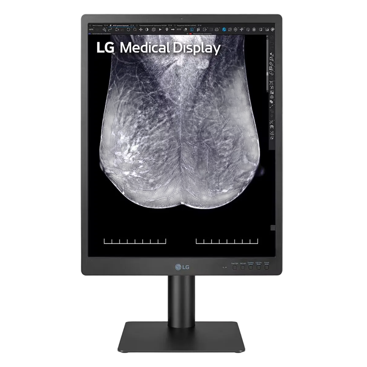 LG 5MP Diagnostic Monitor – Lamb Technologies