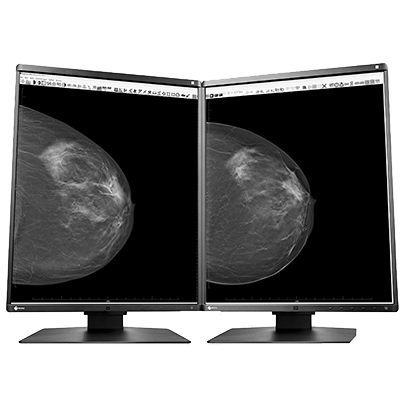 Eizo Radiforce GX560 - Mammography Display