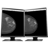 Eizo Radiforce GX560 - Mammography Display