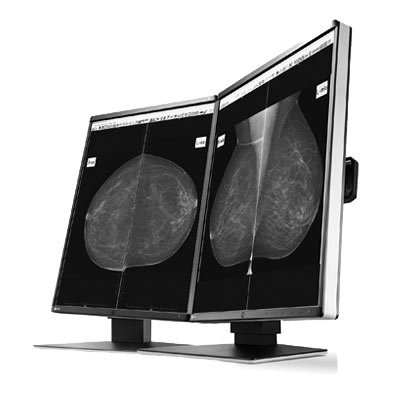 Eizo Radiforce GX560 - Mammography Display