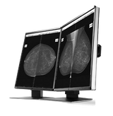 Eizo Radiforce GX560 - Mammography Display