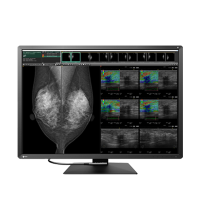 Eizo Radiforce RX1270 - Mammography Display