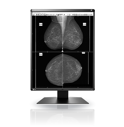 Eizo Radiforce GX560 - Mammography Display