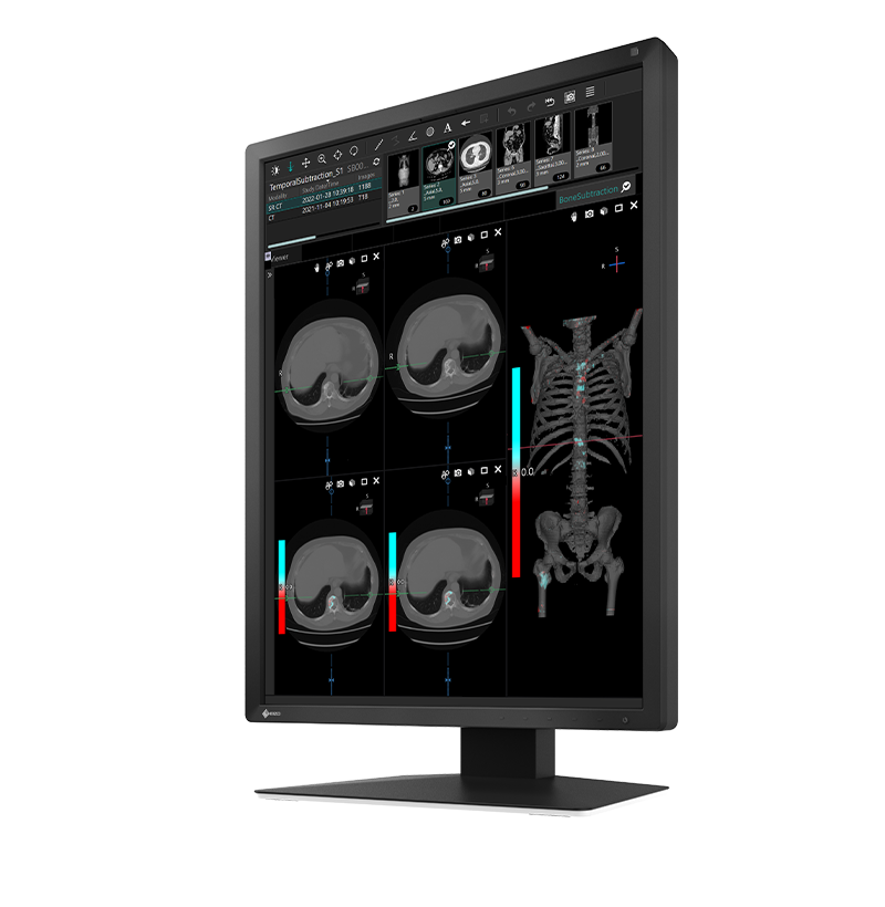 Eizo Radiforce MX217 - Clinical Display