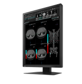 Eizo Radiforce MX217 - Clinical Display