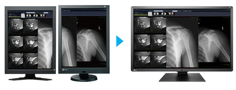 Eizo Radiforce RX660